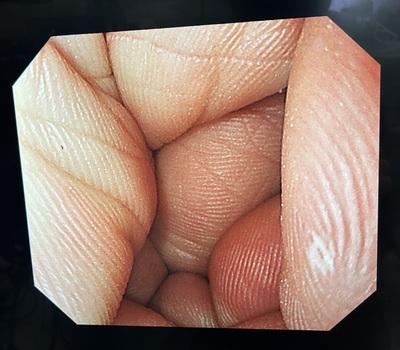 Video Gastroscope&nbsp;|&nbsp;OLYMPUS&nbsp;|&nbsp;GIF-Q240X