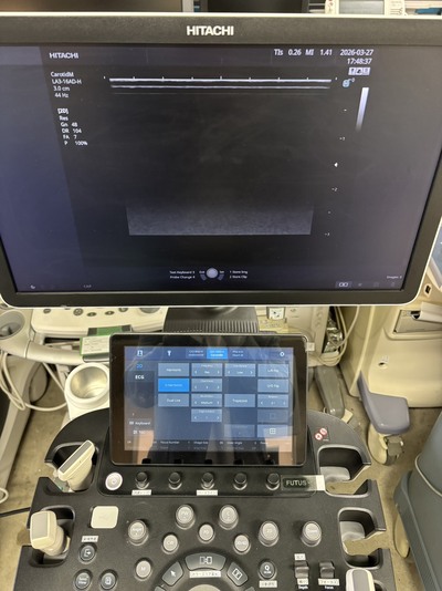 Ultrasound&nbsp;|&nbsp;FUJIFILM&nbsp;|&nbsp;FUTUS