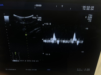 Ultrasound System&nbsp;|&nbsp;HITACHI&nbsp;|&nbsp;Prosound α7