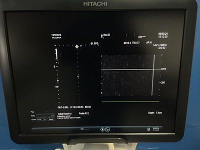 &nbsp;|&nbsp;Fujifilm&nbsp;|&nbsp;ARIETTA 70