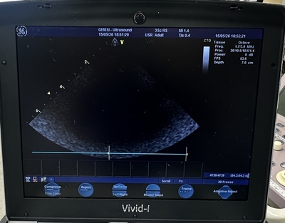 Color Doppler&nbsp;|&nbsp;GE&nbsp;|&nbsp;Vivid i