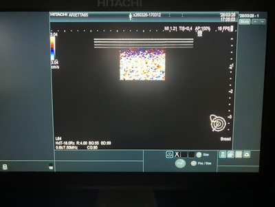 Ultrasound&nbsp;|&nbsp;HITACHI&nbsp;|&nbsp;Arietta 65