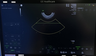 4D Ultrasound&nbsp;|&nbsp;GE&nbsp;|&nbsp;Voluson Swift BT23