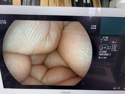 Video Gastroscope&nbsp;|&nbsp;Fujifilm&nbsp;|&nbsp;EG-L580NW7