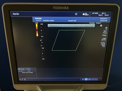 Color Doppler&nbsp;|&nbsp;CANON&nbsp;|&nbsp;TUS-X100 Xario 100