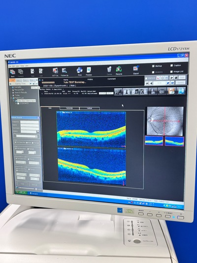 ENTRY Model of OCT&nbsp;|&nbsp;NIDEK&nbsp;|&nbsp;RS-3000 Lite