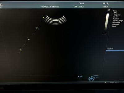 Ultrasound System&nbsp;|&nbsp;GE&nbsp;|&nbsp;Vivid S60N