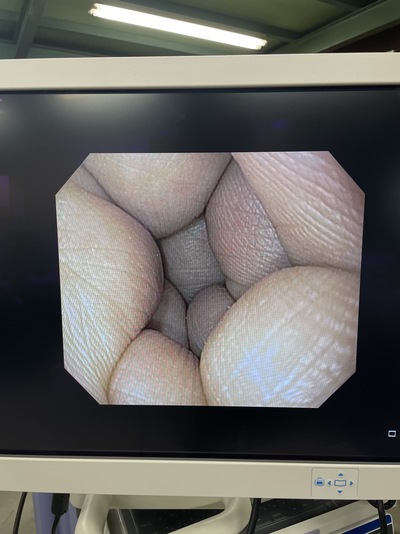 Video Gastroscope&nbsp;|&nbsp;OLYMPUS&nbsp;|&nbsp;GIF-Q150X