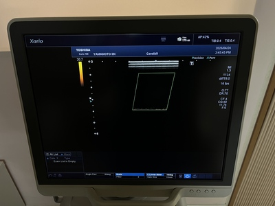 Color Doppler&nbsp;|&nbsp;CANON&nbsp;|&nbsp;TUS-X100 Xario 100