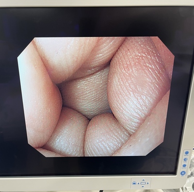 Video Gastroscope&nbsp;|&nbsp;OLYMPUS&nbsp;|&nbsp;GIF-H290