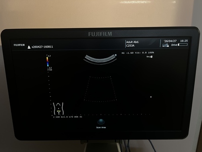 Ultrasound System&nbsp;|&nbsp;FUJIFILM&nbsp;|&nbsp;ARIETTA 50