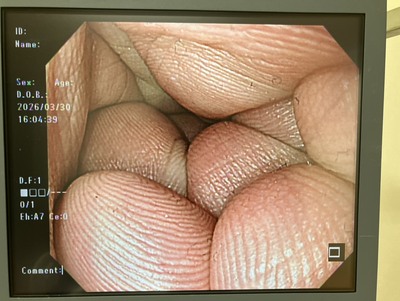 Video Gastroscope&nbsp;|&nbsp;OLYMPUS&nbsp;|&nbsp;GIF-H290