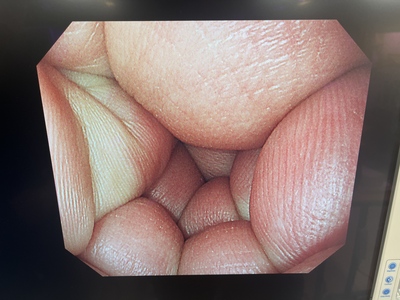 Video Gastroscope&nbsp;|&nbsp;OLYMPUS&nbsp;|&nbsp;GIF-H290