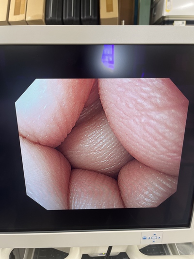 Video Gastroscope&nbsp;|&nbsp;OLYMPUS&nbsp;|&nbsp;GIF-Q240X