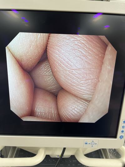 Video Gastroscope&nbsp;|&nbsp;OLYMPUS&nbsp;|&nbsp;GIF-Q240X