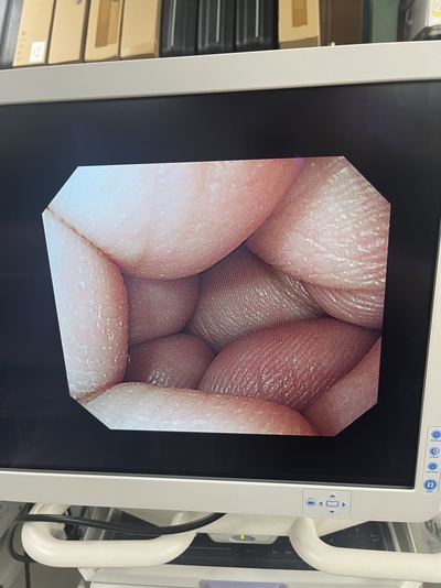 Video Gastroscope&nbsp;|&nbsp;OLYMPUS&nbsp;|&nbsp;GIF-Q240X