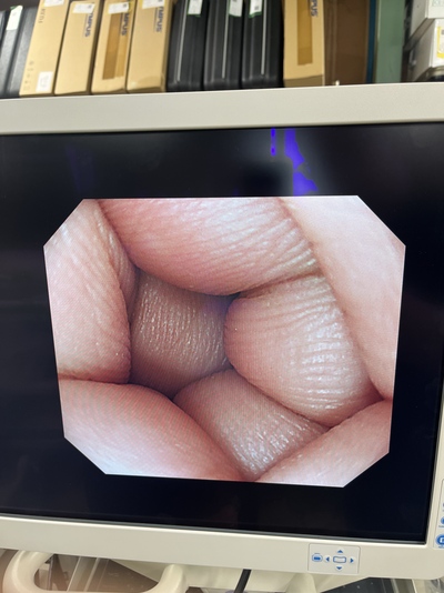 Video Gastroscope&nbsp;|&nbsp;OLYMPUS&nbsp;|&nbsp;GIF-Q240Z