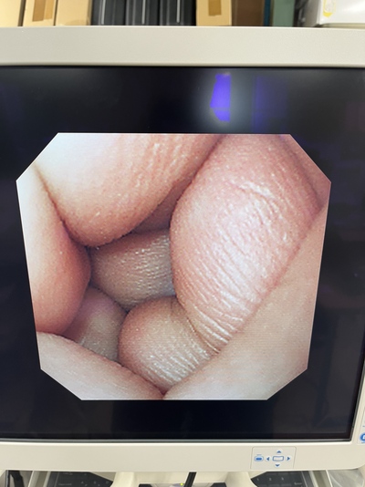 Video Gastroscope&nbsp;|&nbsp;OLYMPUS&nbsp;|&nbsp;GIF-XQ240