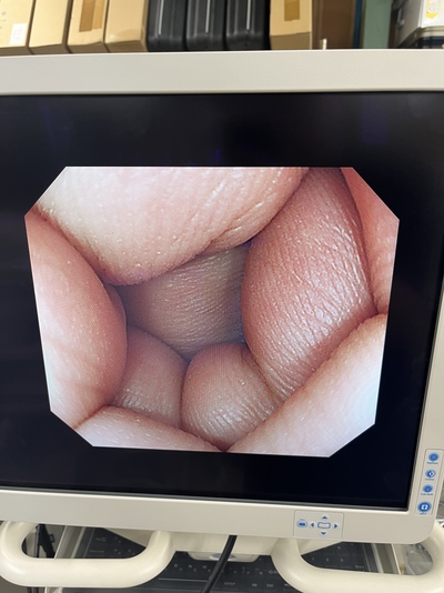 Video Colonoscope&nbsp;|&nbsp;OLYMPUS&nbsp;|&nbsp;PCF-Q240ZI