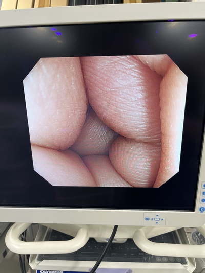 Video Colonoscope&nbsp;|&nbsp;OLYMPUS&nbsp;|&nbsp;PCF-Q240ZI