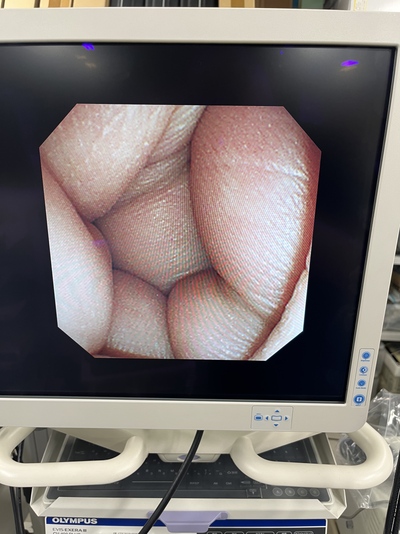 Video Gastroscope&nbsp;|&nbsp;OLYMPUS&nbsp;|&nbsp;GIF-XP260