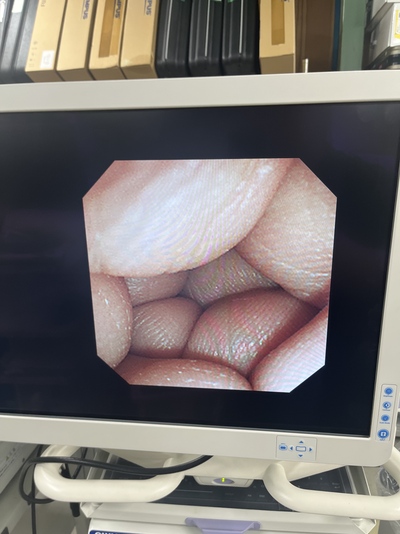 Video Gastroscope&nbsp;|&nbsp;OLYMPUS&nbsp;|&nbsp;GIF-XP260N