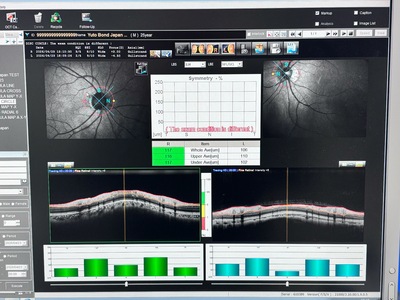 ANGIOGRAPHY installed OCT&nbsp;|&nbsp;NIDEK&nbsp;|&nbsp;RS-3000 Advance