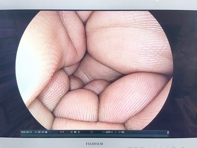 Video Gastroscope&nbsp;|&nbsp;FUJIFILM&nbsp;|&nbsp;EG-590WR2