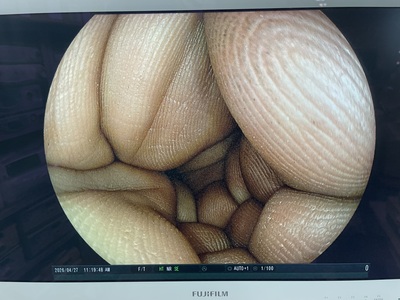 Gastroscope&nbsp;|&nbsp;FUJIFILM&nbsp;|&nbsp;EG-590WR