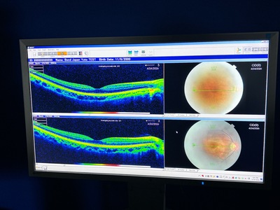 Windows 7 Pro OCT&nbsp;|&nbsp;TOPCON&nbsp;|&nbsp;3D OCT 2000 FA