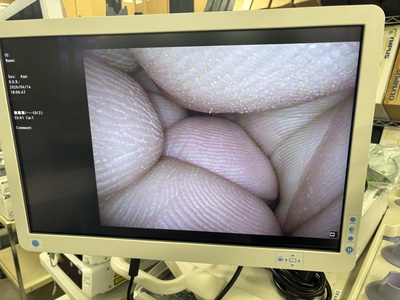 Video Rhinolaryngoscope&nbsp;|&nbsp;OLYMPUS&nbsp;|&nbsp;ENF-VQ
