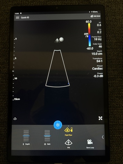 Mobile Ultrasound&nbsp;|&nbsp;PHILIPS&nbsp;|&nbsp;795005/Lumify System