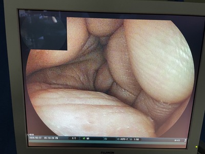 Video Gastroscope&nbsp;|&nbsp;FUJIFILM&nbsp;|&nbsp;EG-530NW