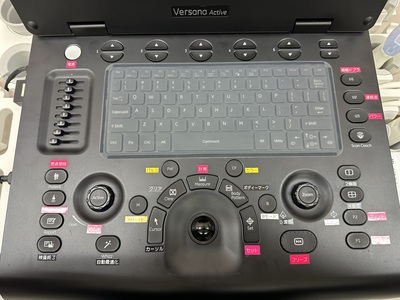 Ultrasound&nbsp;|&nbsp;GE&nbsp;|&nbsp;Versana Active