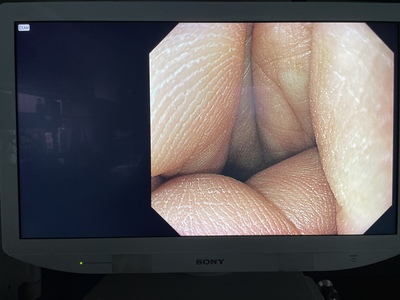 Video Gastroscope&nbsp;|&nbsp;OLYMPUS&nbsp;|&nbsp;GIF-H290Z