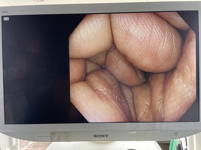 Colonoscope&nbsp;|&nbsp;OLYMPUS&nbsp;|&nbsp;CF-HQ290ZI