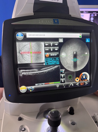Advanced OCT + Fundus camera&nbsp;|&nbsp;NIDEK&nbsp;|&nbsp;RS-330 Retina Scan Duo