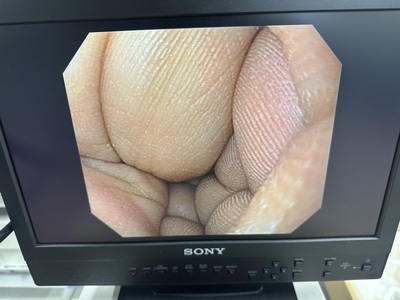 Video Gastroscope&nbsp;|&nbsp;OLYMPUS&nbsp;|&nbsp;GIF-Q150X