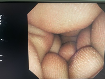 Video Gastroscope&nbsp;|&nbsp;OLYMPUS&nbsp;|&nbsp;GIF-XP260