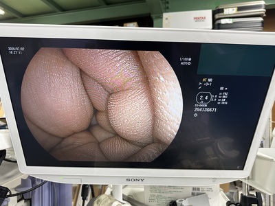 Video Gastroscope&nbsp;|&nbsp;FUJIFILM&nbsp;|&nbsp;EG-6400N