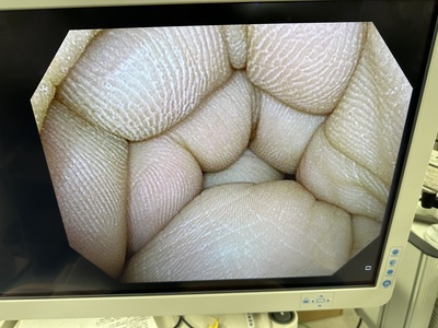 Cystoscope&nbsp;|&nbsp;OLYMPUS&nbsp;|&nbsp;CYF-VHA