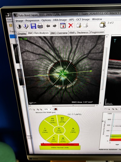 HRA2+ OCT+ WWE(55°), Retina and Glaucoma Module&nbsp;|&nbsp;Heidelberg Engineering GmbH&nbsp;|&nbsp;SPECTRALIS OCT2