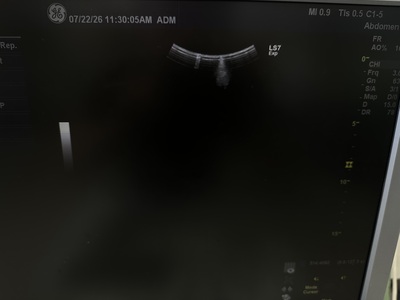 Color Doppler&nbsp;|&nbsp;GE&nbsp;|&nbsp;Logiq S7 Expert