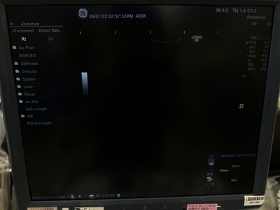 Color Doppler&nbsp;|&nbsp;GE&nbsp;|&nbsp;LOGIQ E9