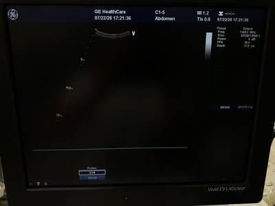 Ultrasound&nbsp;|&nbsp;GE&nbsp;|&nbsp;Vivid E9
