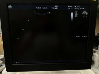 Ultrasound&nbsp;|&nbsp;GE&nbsp;|&nbsp;Vivid E9