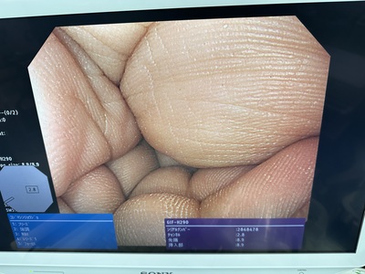 Video Gastroscope&nbsp;|&nbsp;OLYMPUS&nbsp;|&nbsp;GIF-H290