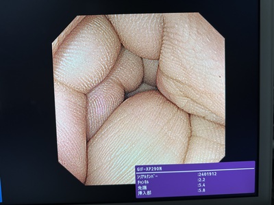 Video Gastroscope&nbsp;|&nbsp;OLYMPUS&nbsp;|&nbsp;GIF-XP290N