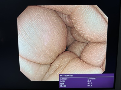 Video Colonoscope&nbsp;|&nbsp;OLYMPUS&nbsp;|&nbsp;PCF-Q260AZI