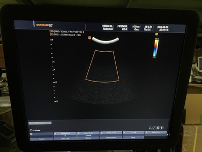 3D Ultrasound&nbsp;|&nbsp;SAMSUNG MEDISON&nbsp;|&nbsp;SonoAce R7